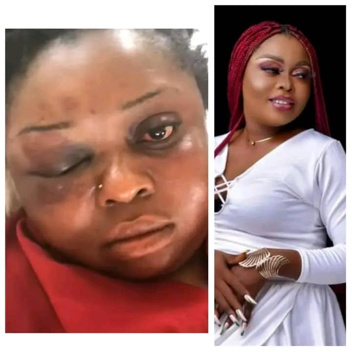 Man Beats Ex-girlfriend For Refusing To Marry Him In Delta